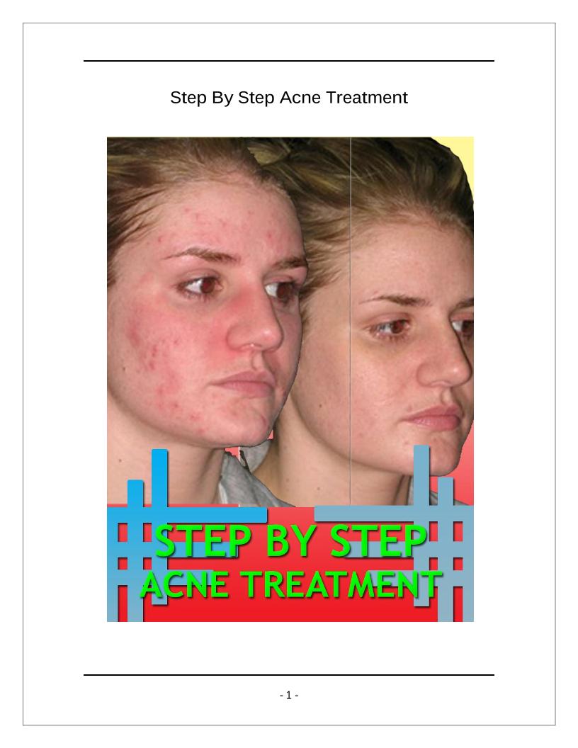 The Ultimate eBook Guide to Preventing and Treating Acne Naturally